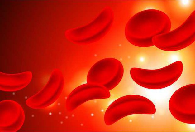 sickle cell